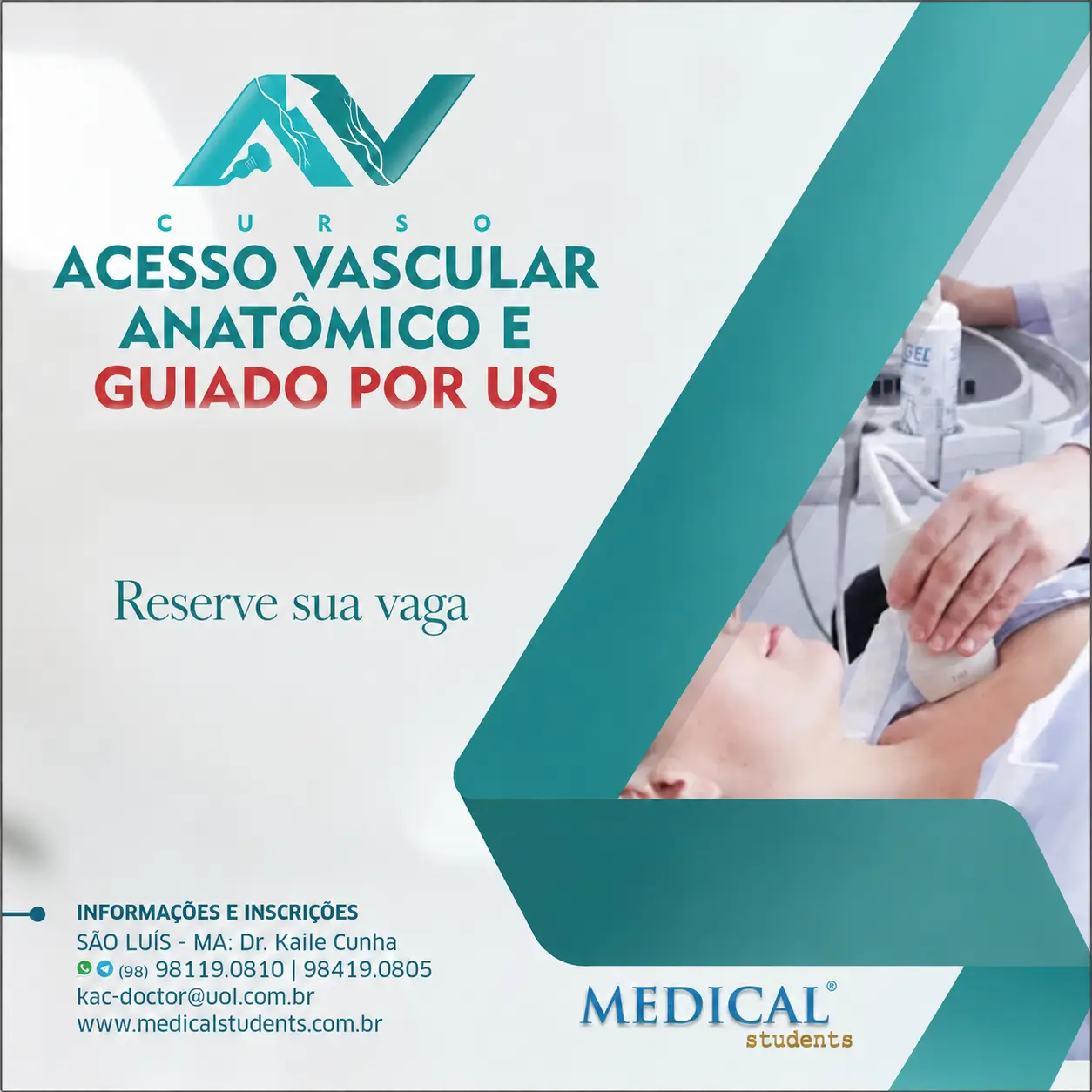 Acesso Vascular Anatômico e Guiado por US